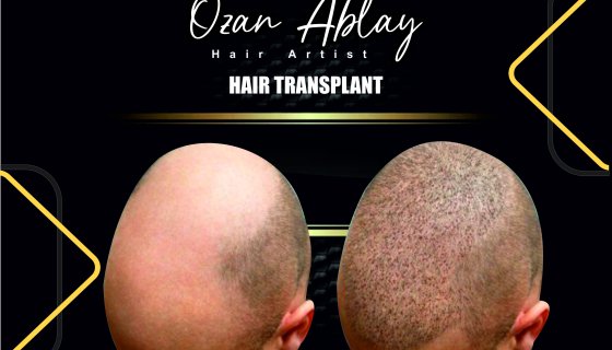 Müşterimiz ( İsmi Açıklanmayan )