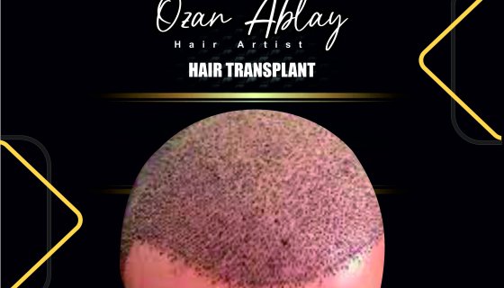 Müşterimiz ( İsmi Açıklanmayan )