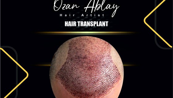 Müşterimiz ( İsmi Açıklanmayan )