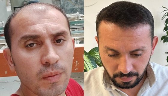 Müşterilerimizden Gelenler 2